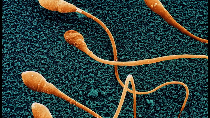 Spermatozoi creati in laboratorio: gli scienziati si avvicinano sempre più a una svolta nel campo della fertilità - Le Scienze
