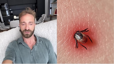 Morso da una zecca in Sud Africa, come sta Stefano Corti: “Pensavo fosse un pelo incarnito, l’infettivologa ha subito capito tutto”